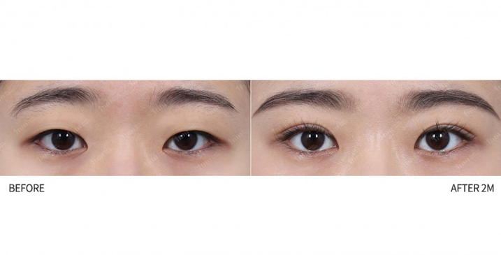 Slider image (7) 1mm Plastic Surgery